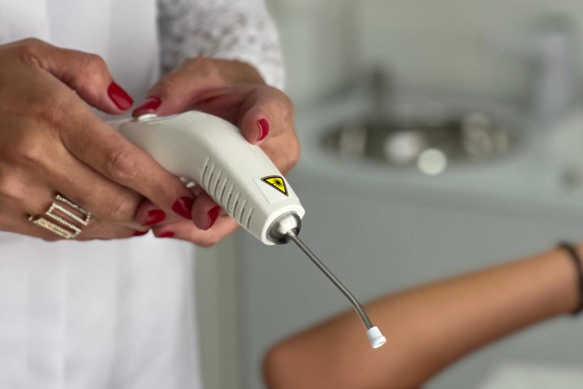 Acupuntura a laser ou acupuntura sem agulhas